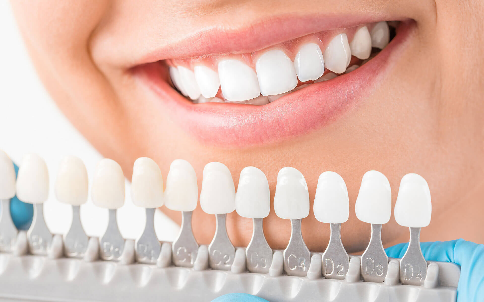 Dental-implants-outside Dental-implants-outside